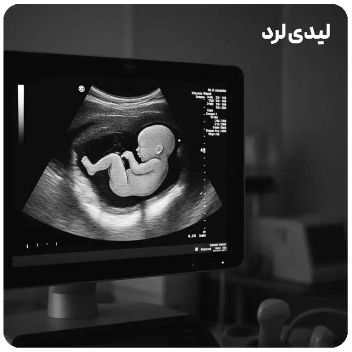 تفسیر ساده سونوگرافی NT و عدد نرمال آن؛ چه زمانی باید نگران شویم؟