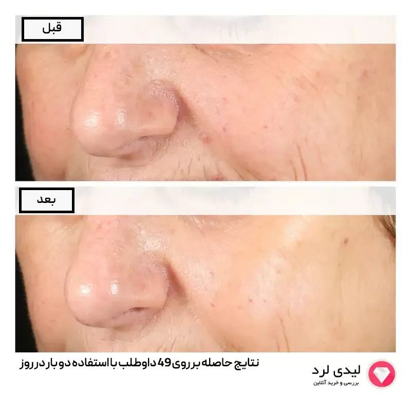 برای بزرگنمایی تصویر دوبار کلیک نمایید سرم پوست دی اوردینری مدل آلفا آربوتین حجم 30 میلی لیتر