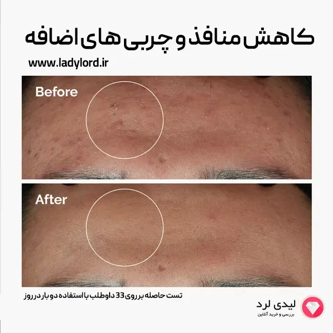 برای بزرگنمایی تصویر دوبار کلیک نمایید سرم پوست دی اوردینری مدل zinc1% niacinamide10% حجم 30 میلی لیتر