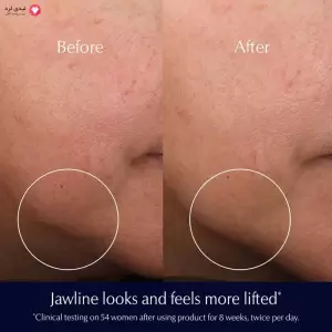 کرم ضد چروک استی لادر مدل  revitalizing supreme حجم 75 میلی لیتر